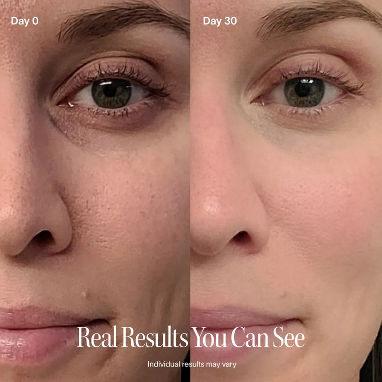 Torza LumaLift™ Facial Wand