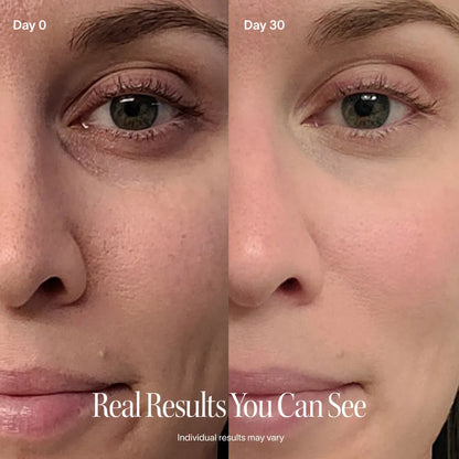 Torza LumaLift™ Facial Wand
